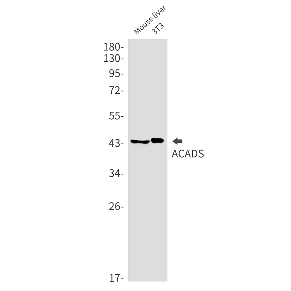 Rabbit monoclonal antibody