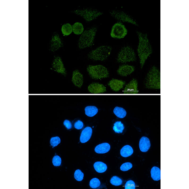 Rabbit monoclonal antibody