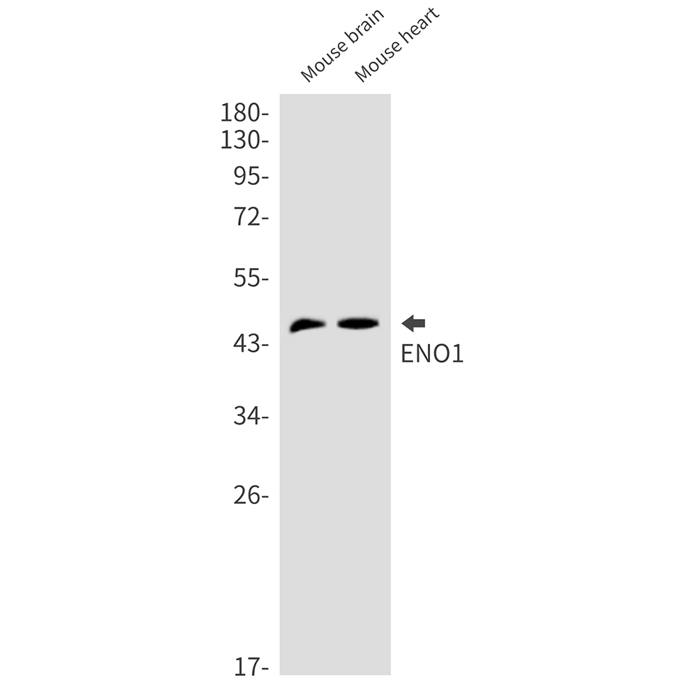 Rabbit monoclonal antibody