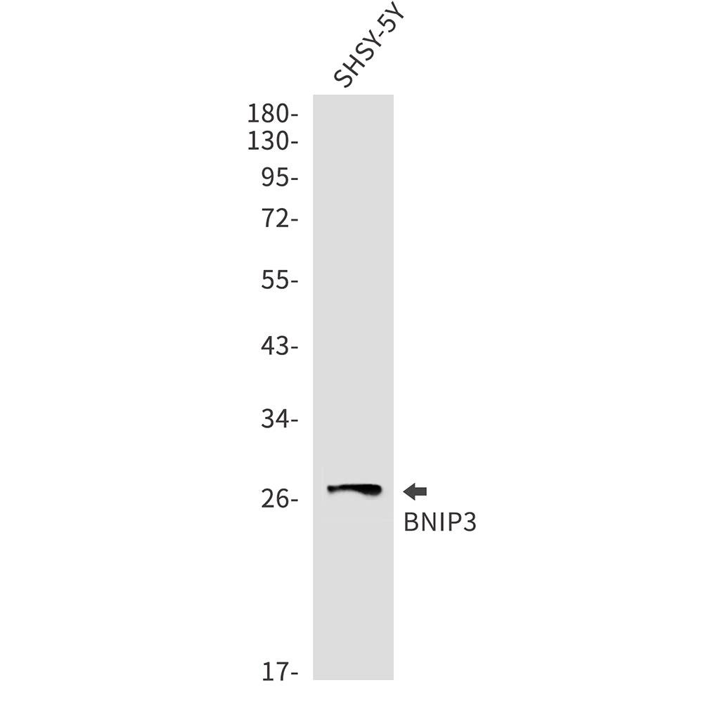 Rabbit monoclonal antibody