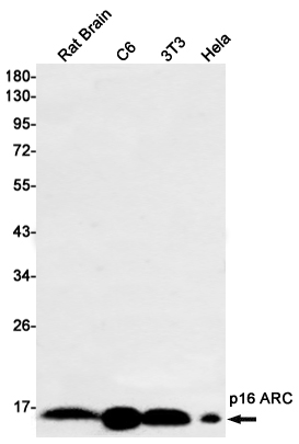Rabbit monoclonal antibody