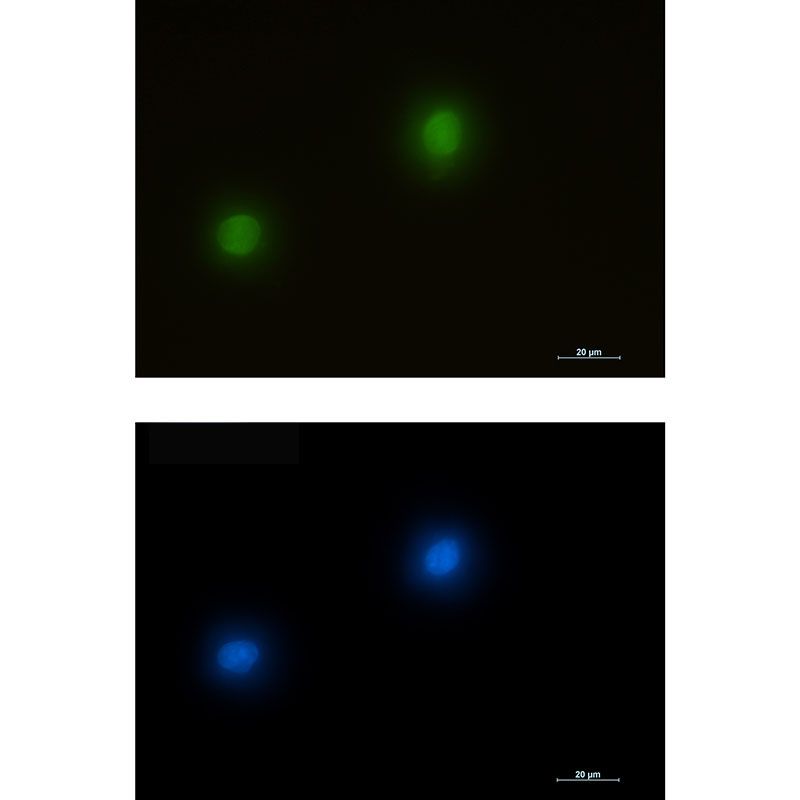 Rabbit monoclonal antibody