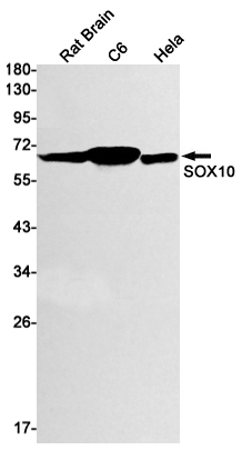 Rabbit monoclonal antibody