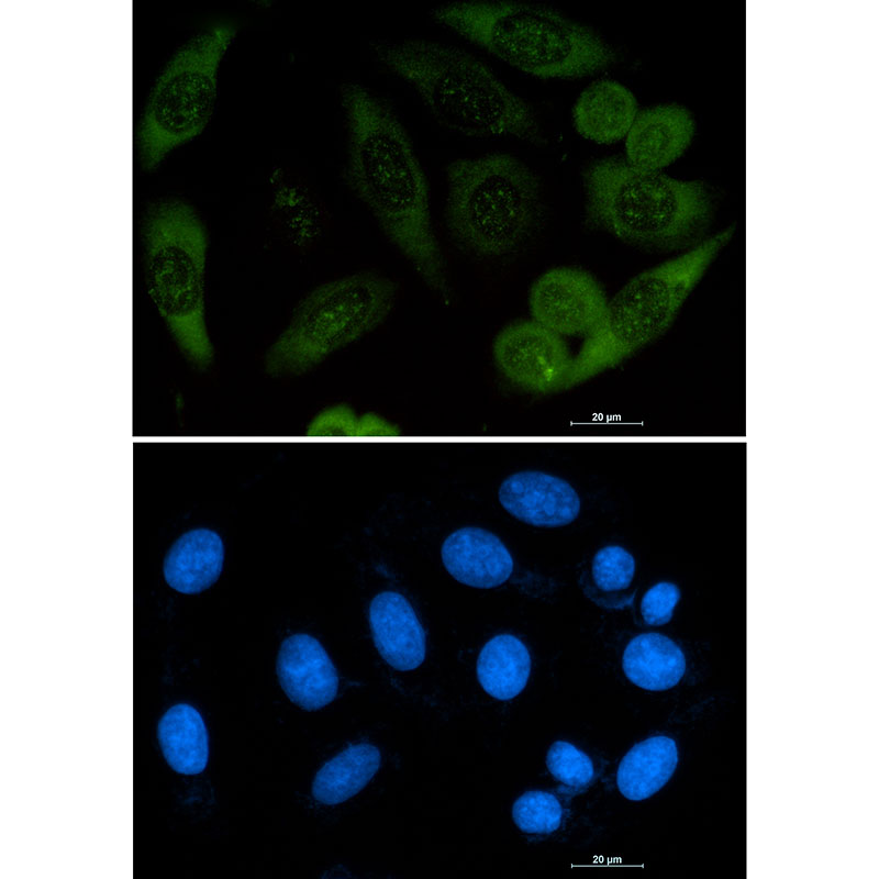 Rabbit monoclonal antibody