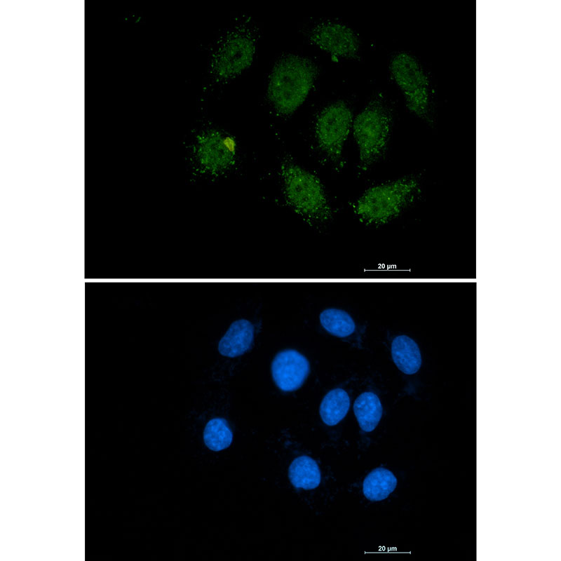 Rabbit monoclonal antibody