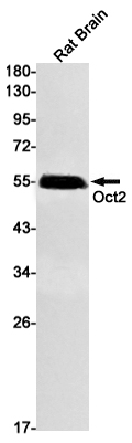 Rabbit monoclonal antibody