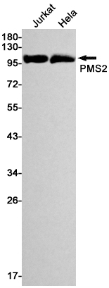 Rabbit monoclonal antibody