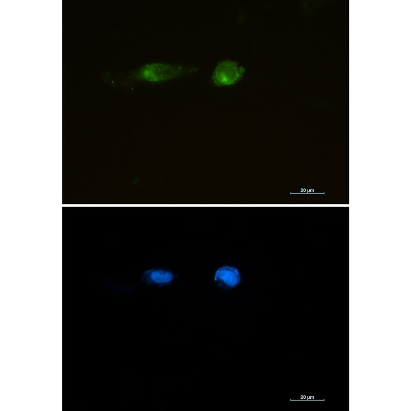 Rabbit monoclonal antibody