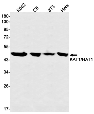 Rabbit monoclonal antibody