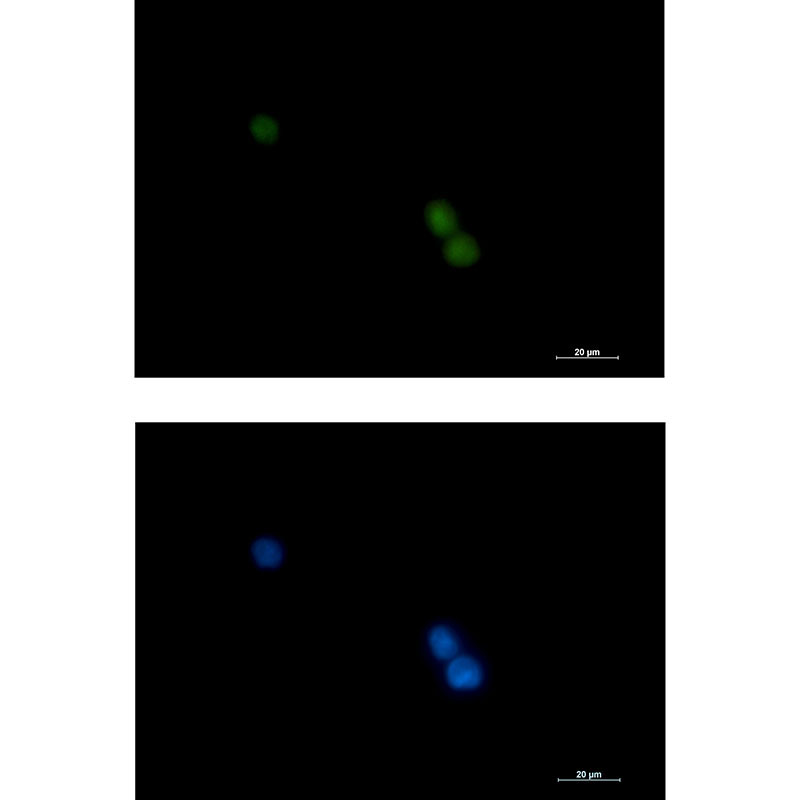 Rabbit monoclonal antibody