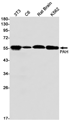 Rabbit monoclonal antibody