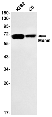 Rabbit monoclonal antibody