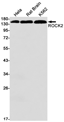 Rabbit monoclonal antibody