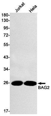 Rabbit monoclonal antibody