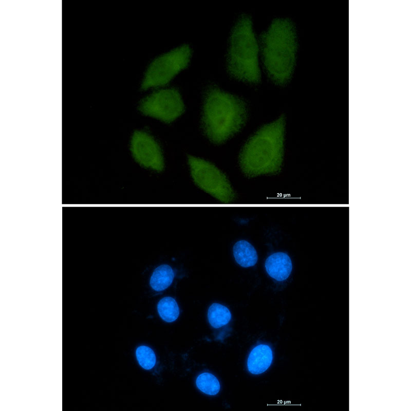 Rabbit monoclonal antibody