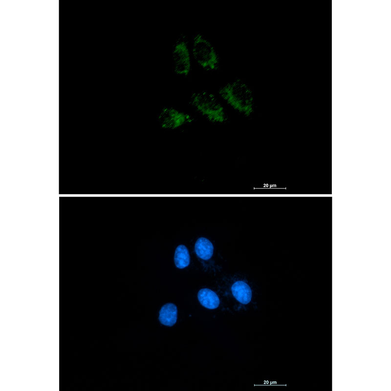 Rabbit monoclonal antibody