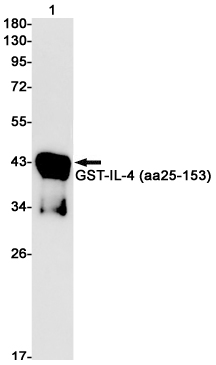 Rabbit monoclonal antibody