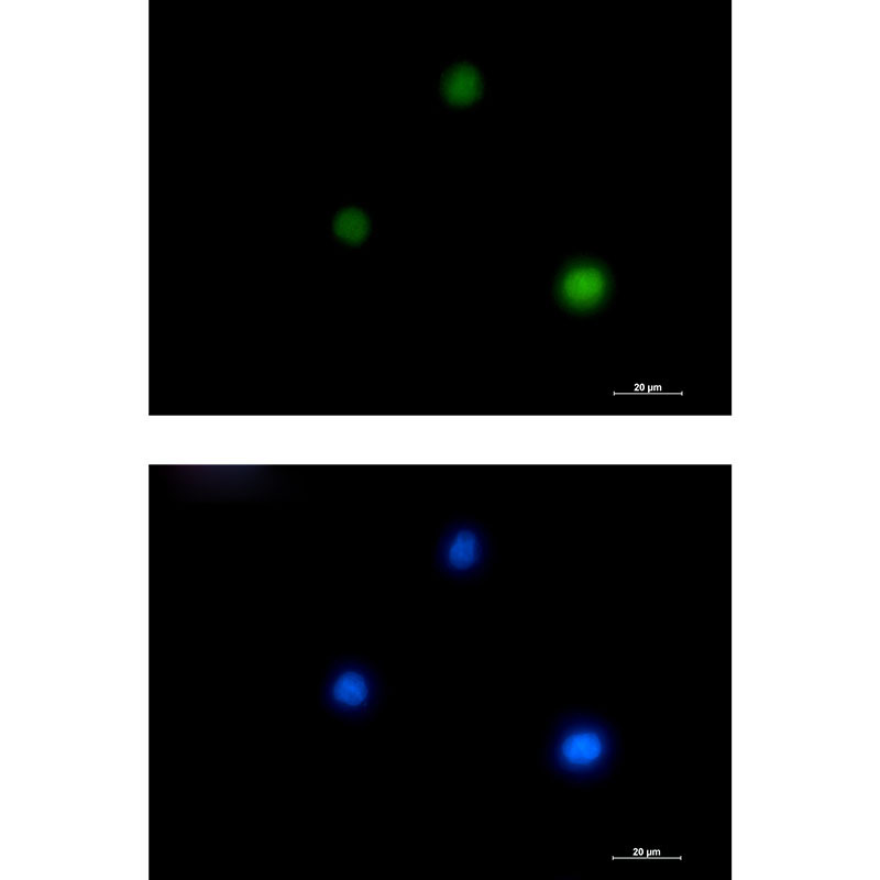 Rabbit monoclonal antibody
