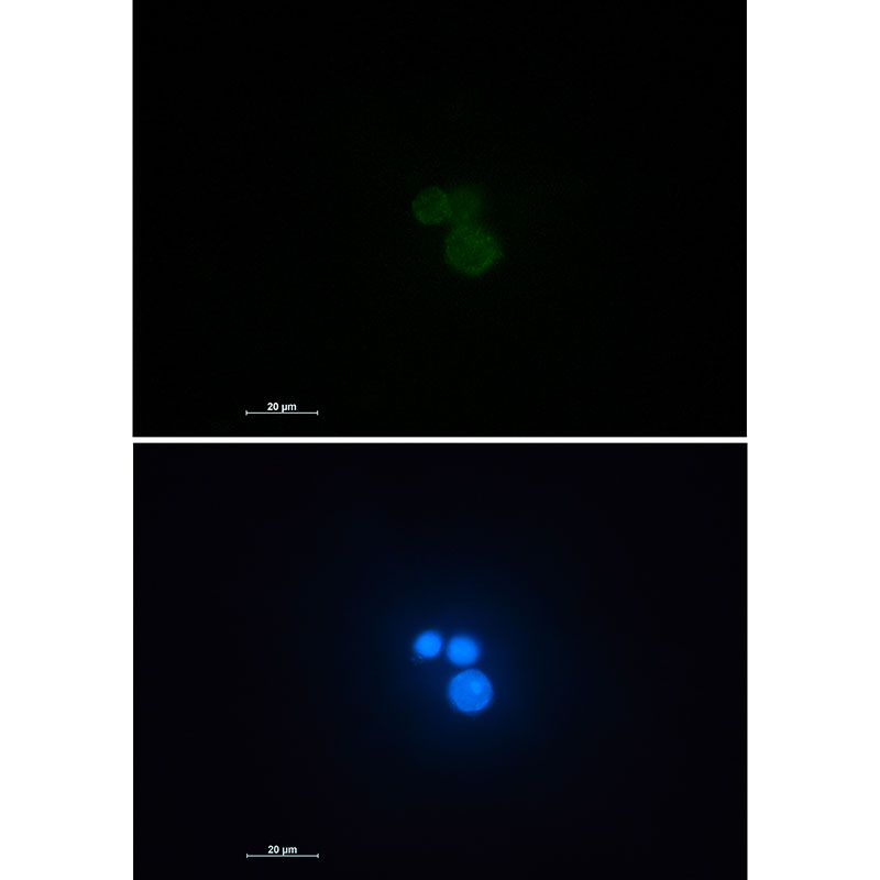 Rabbit monoclonal antibody