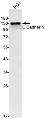 Rabbit monoclonal antibody