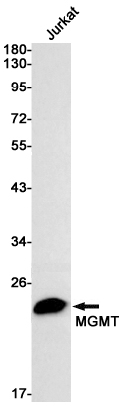 Rabbit monoclonal antibody