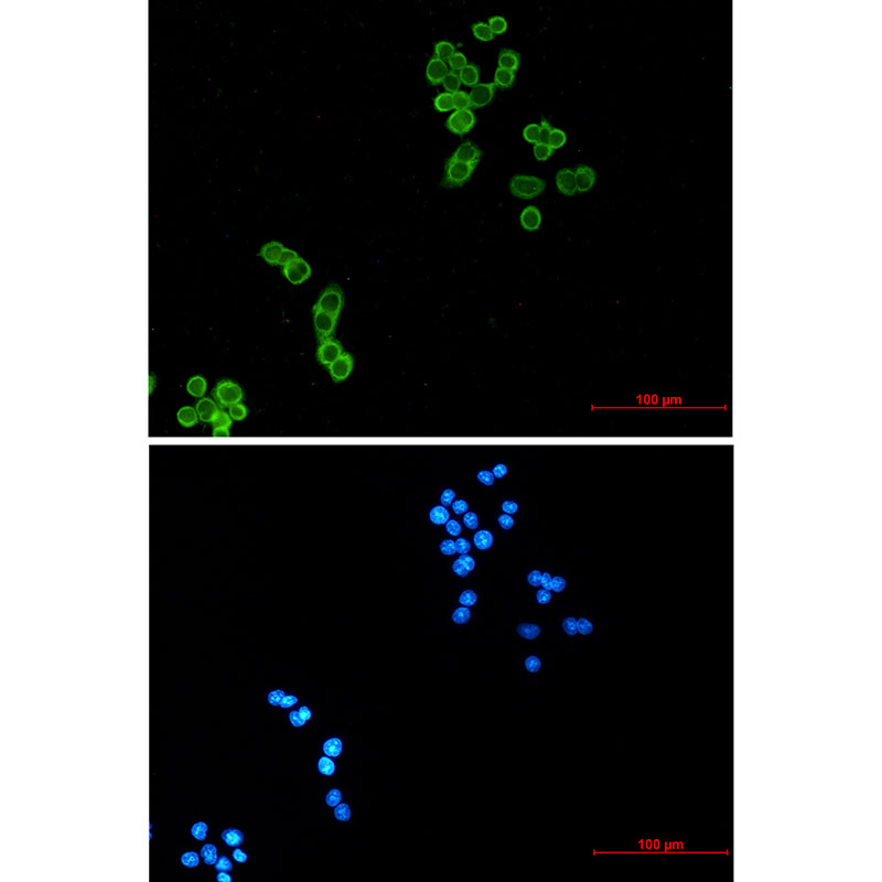 Rabbit monoclonal antibody