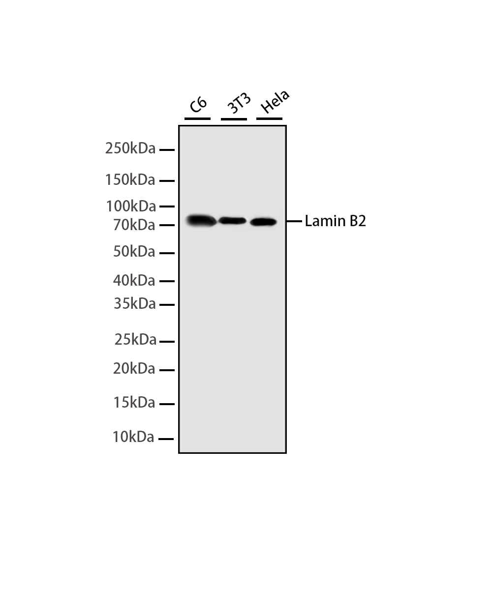 Rabbit monoclonal antibody
