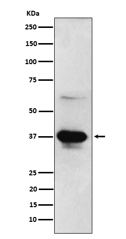 Rabbit monoclonal antibody