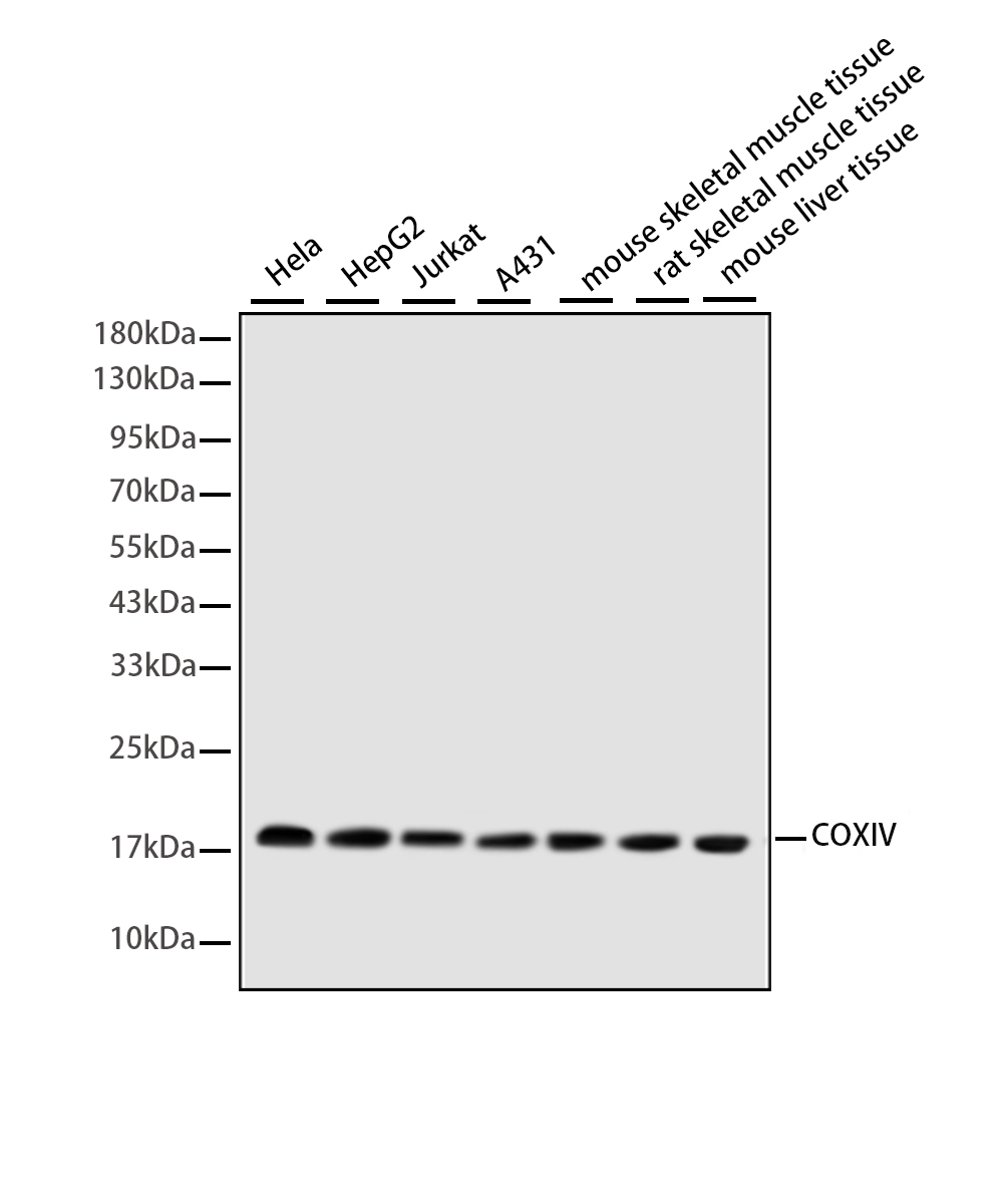 Rabbit monoclonal antibody