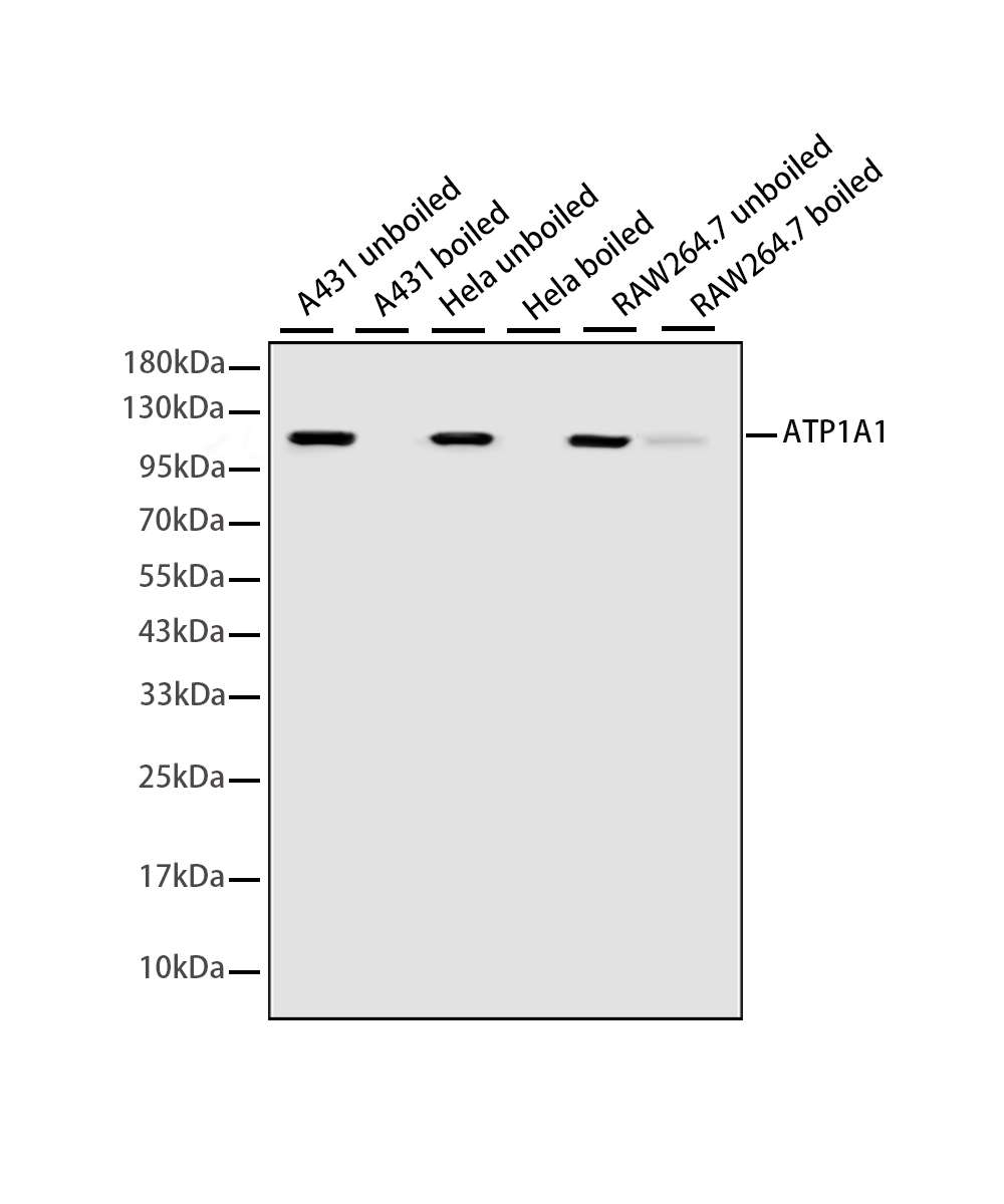 Rabbit monoclonal antibody