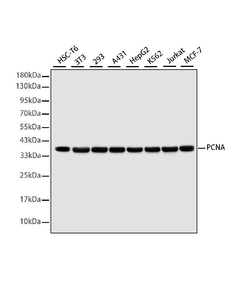 Rabbit monoclonal antibody