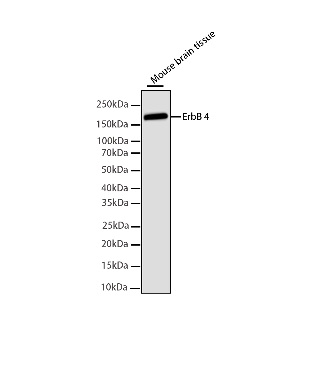 Rabbit monoclonal antibody